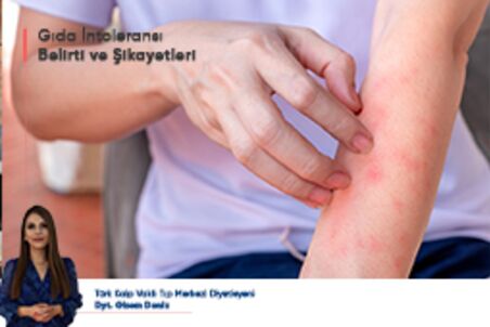 Gıda İntoleransı Belirti ve Şikayetleri Gıda İntoleransı Belirti ve Şikayetleri